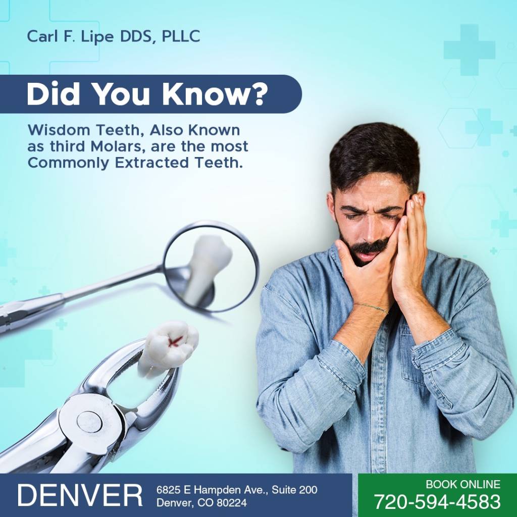 Can I Brush My Teeth After Wisdom Tooth Removal